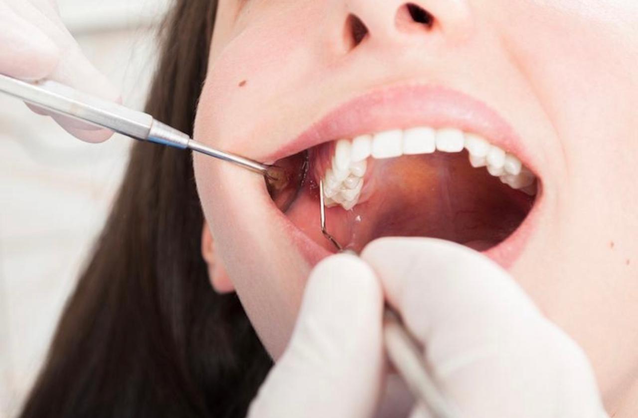 Periodontia - Clínica Odontológica Tornelli