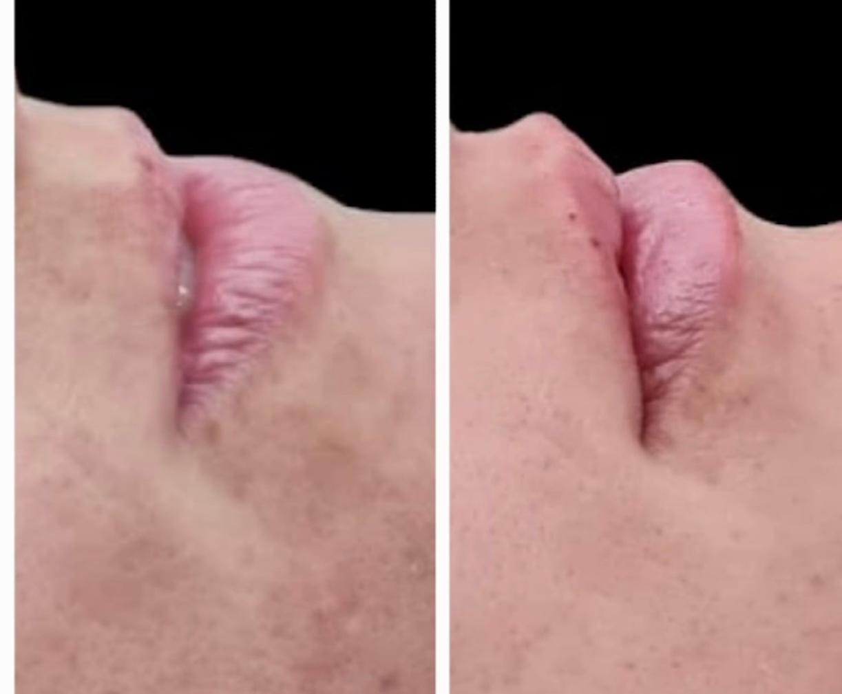 Harmonização Facial - Clínica Odontológica Tornelli