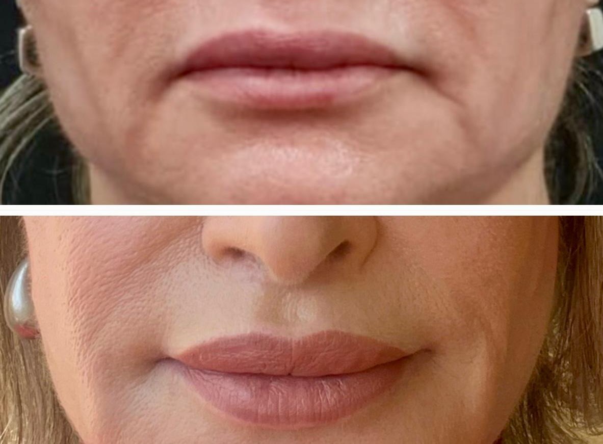 Cirurgias Estéticas da Face - Clínica Odontológica Tornelli